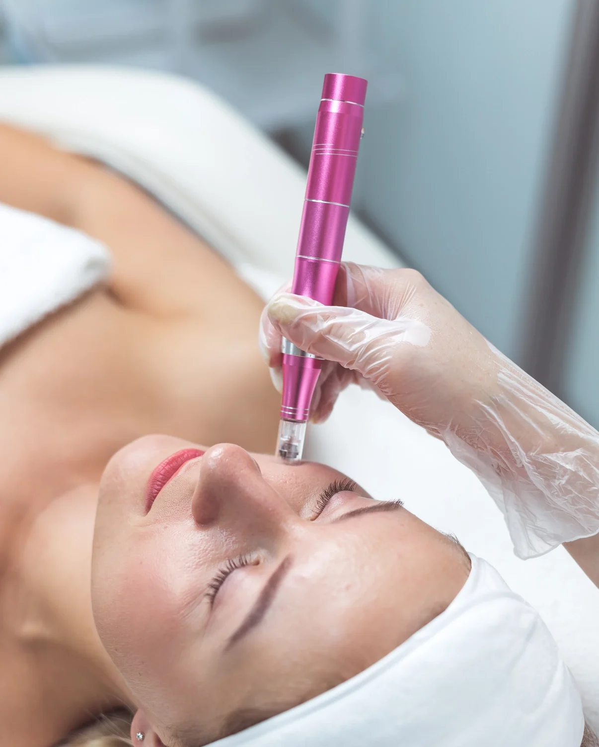 woman-having-facial-treatment-in-beauty-salon-clo-2023-11-27-05-36-41-utc Microneedling